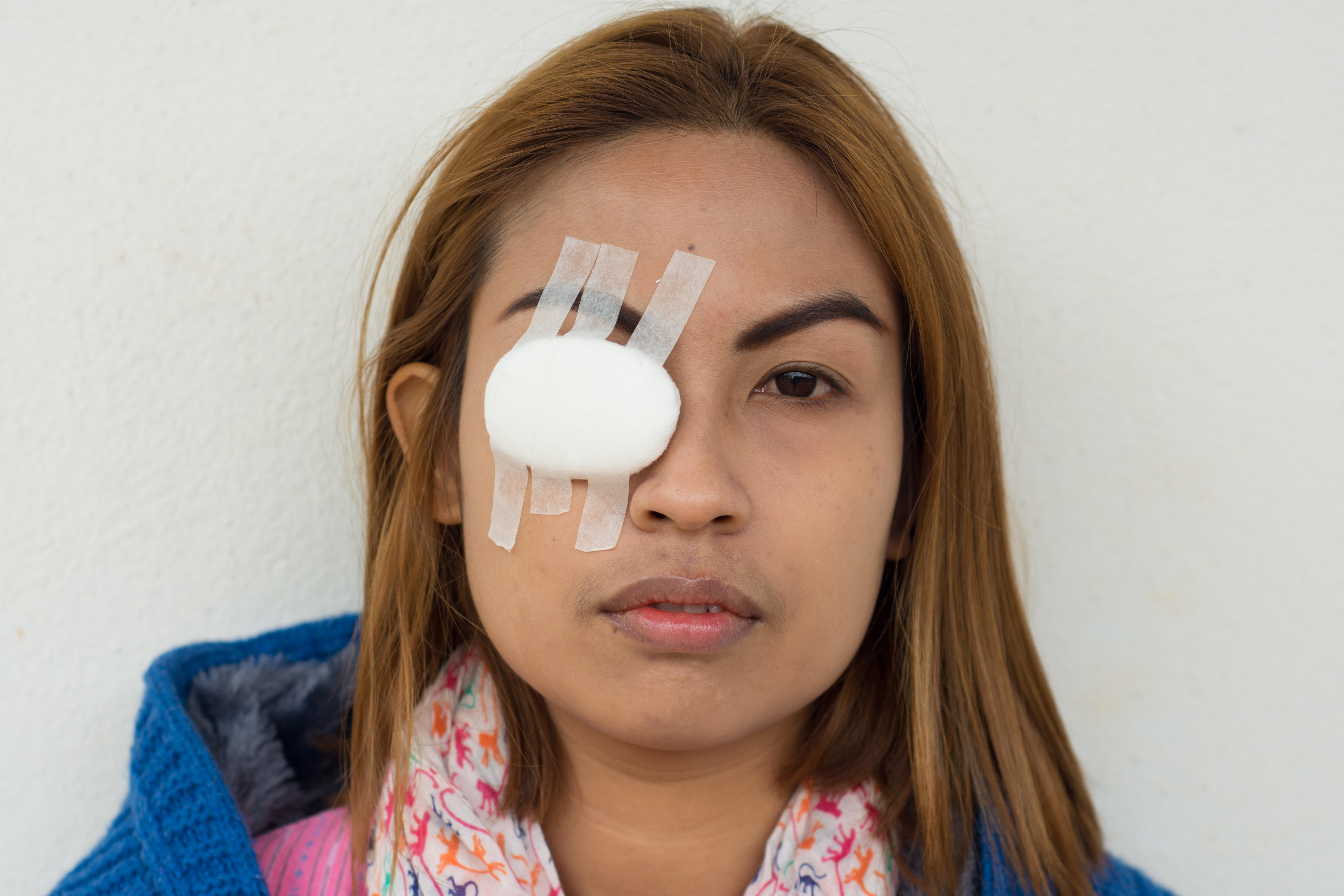 woman with eye patch