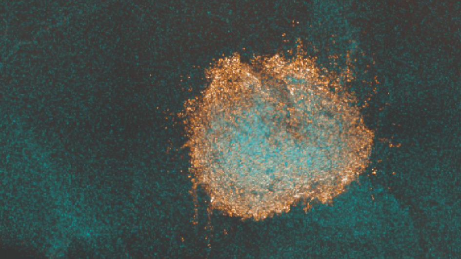 Diffuse midline glioma cells