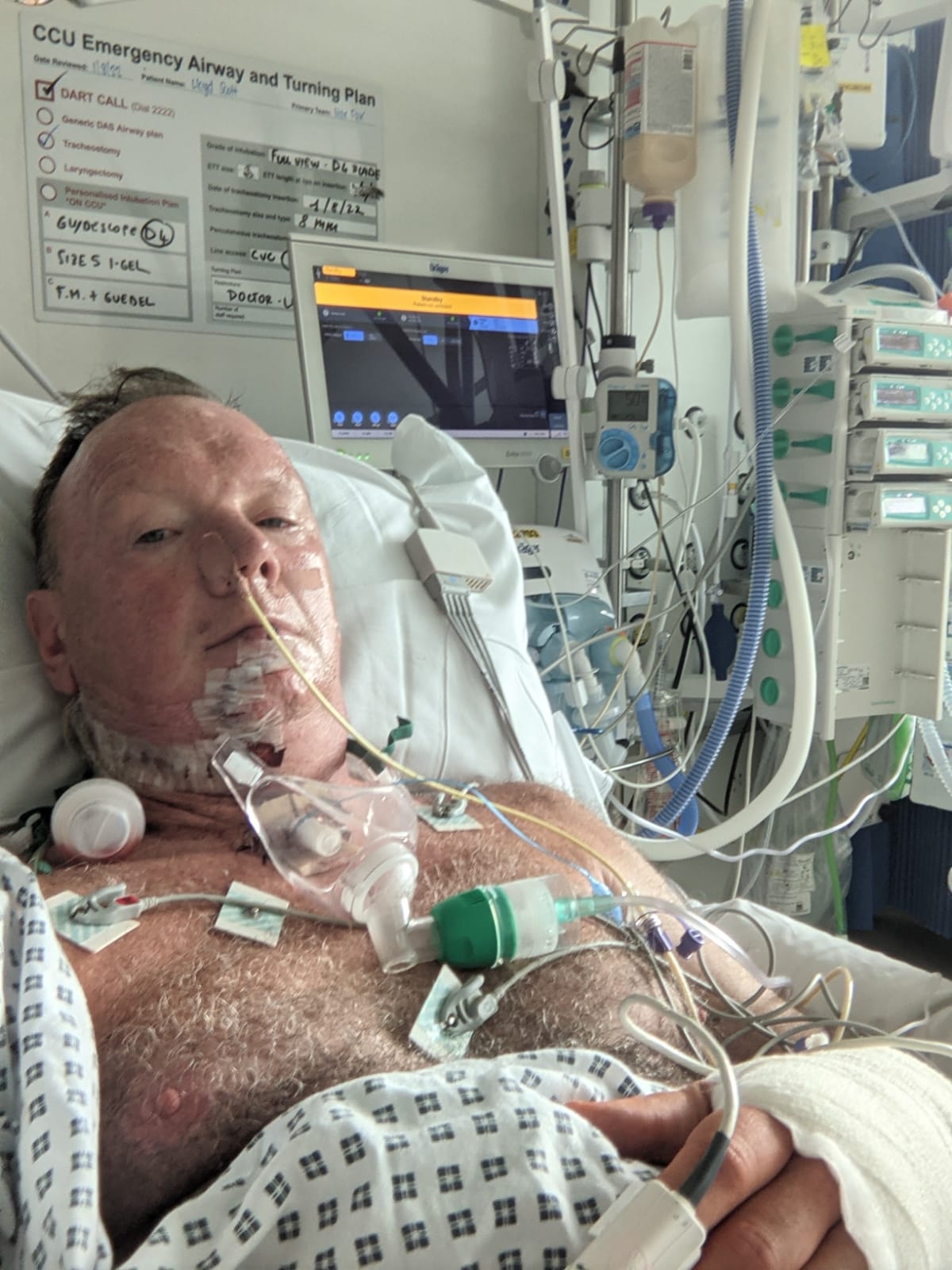 Man in hospital bed with tubes 