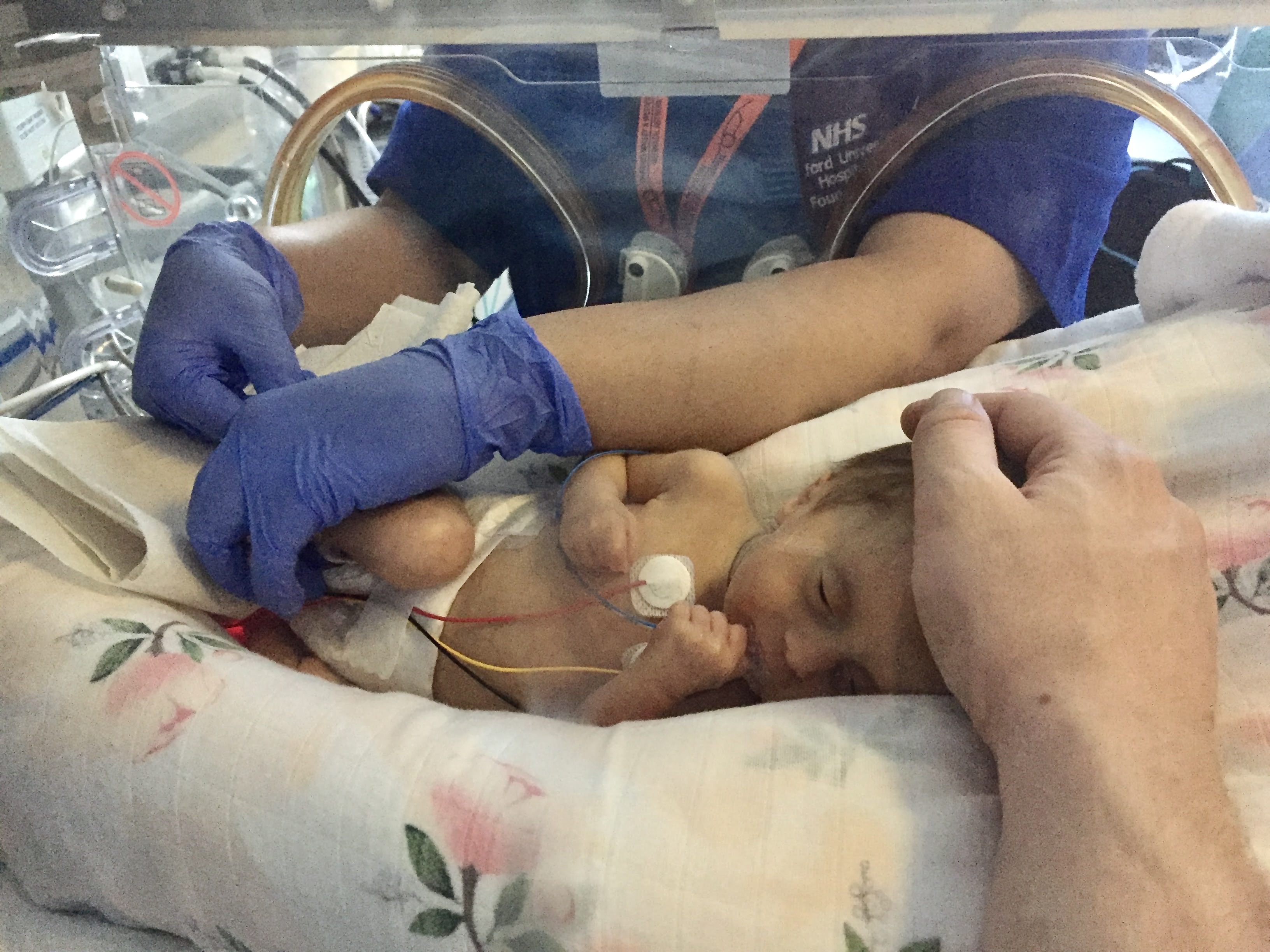 Sofia in neonatal care unit at John Radcliffe Hospital in Oxford 