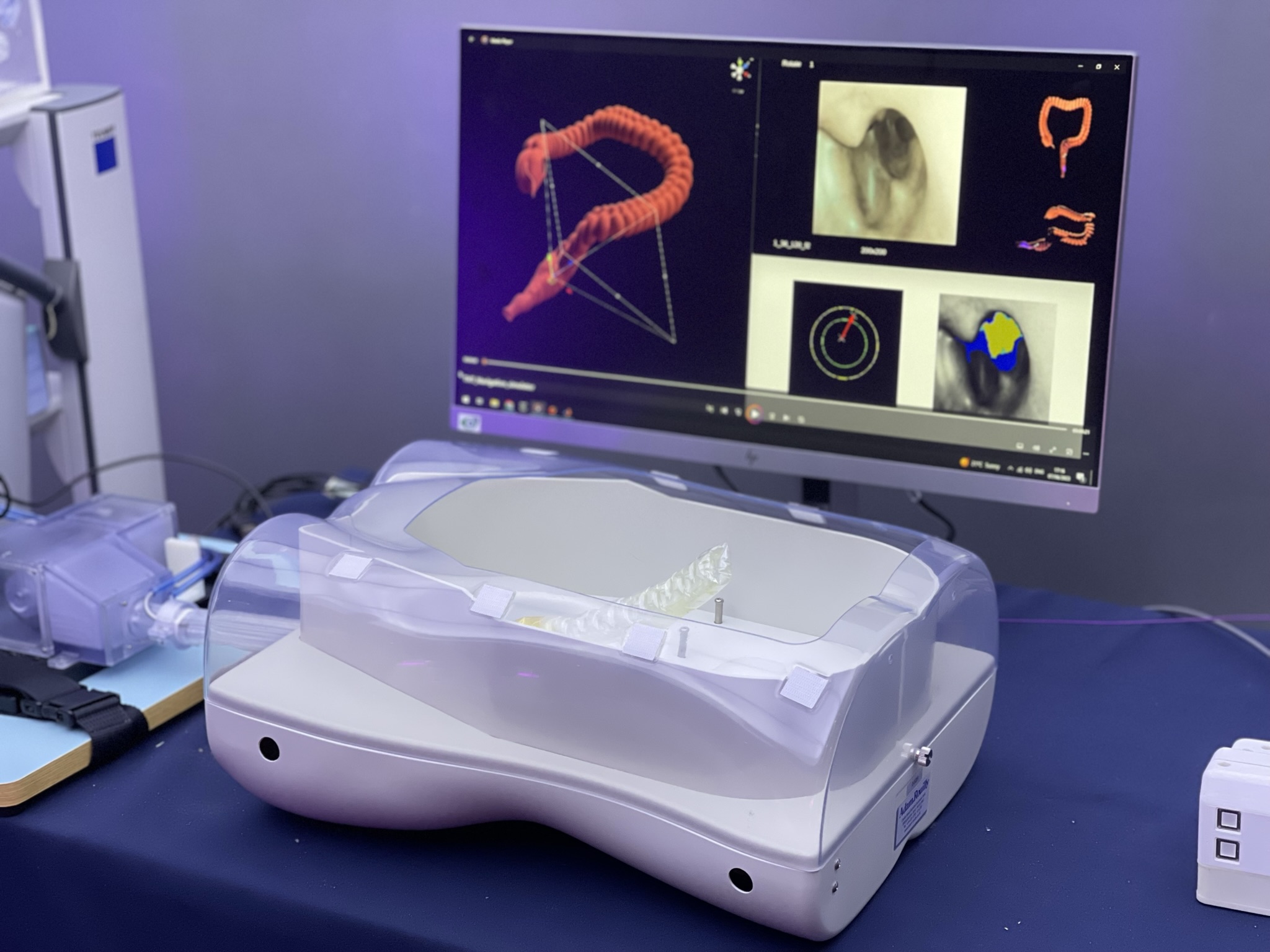 The robotic endoscope can self propel through the body