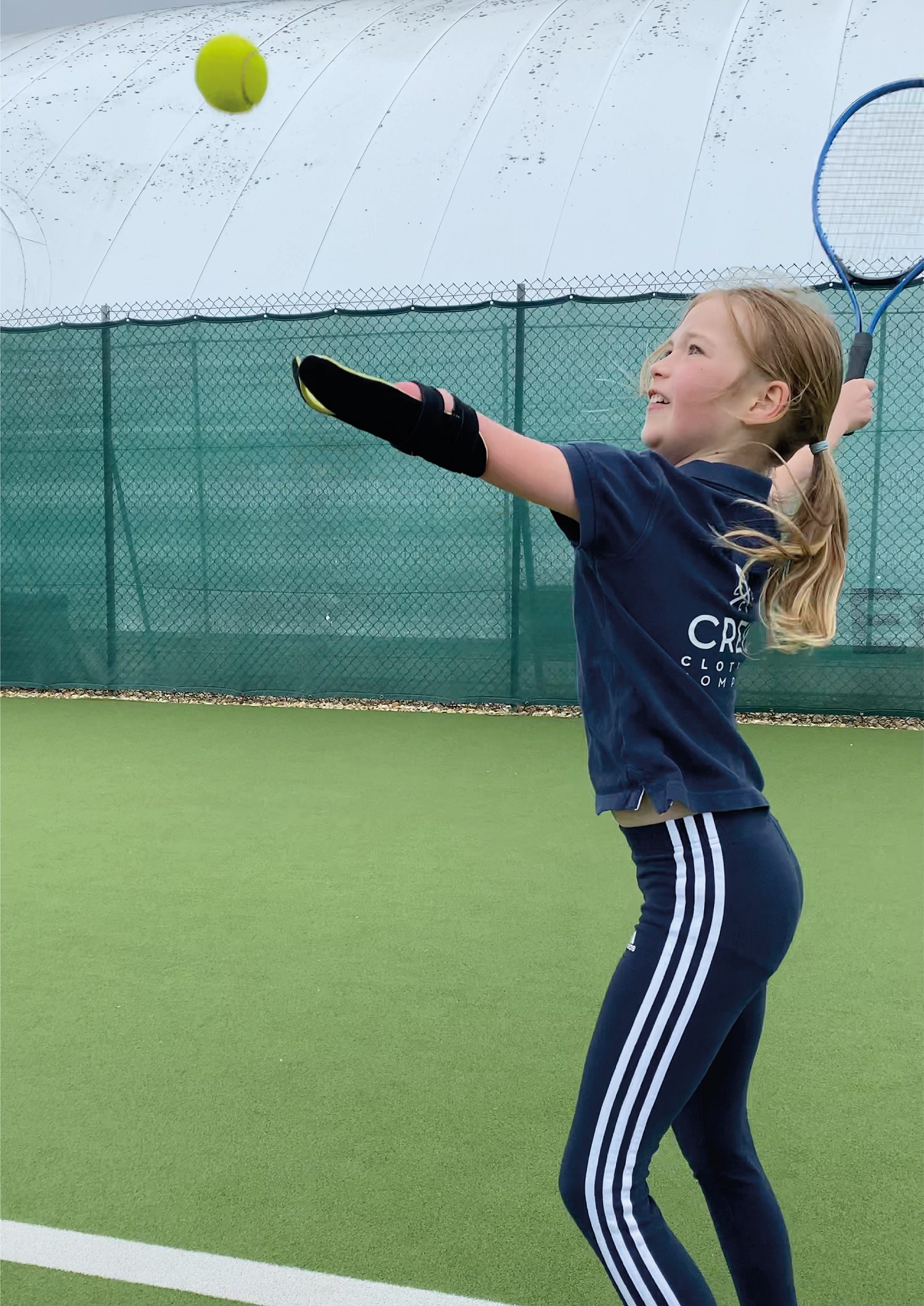 Joanie serving with her Koalaa prosthetic