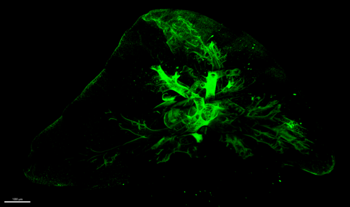 Flu lung