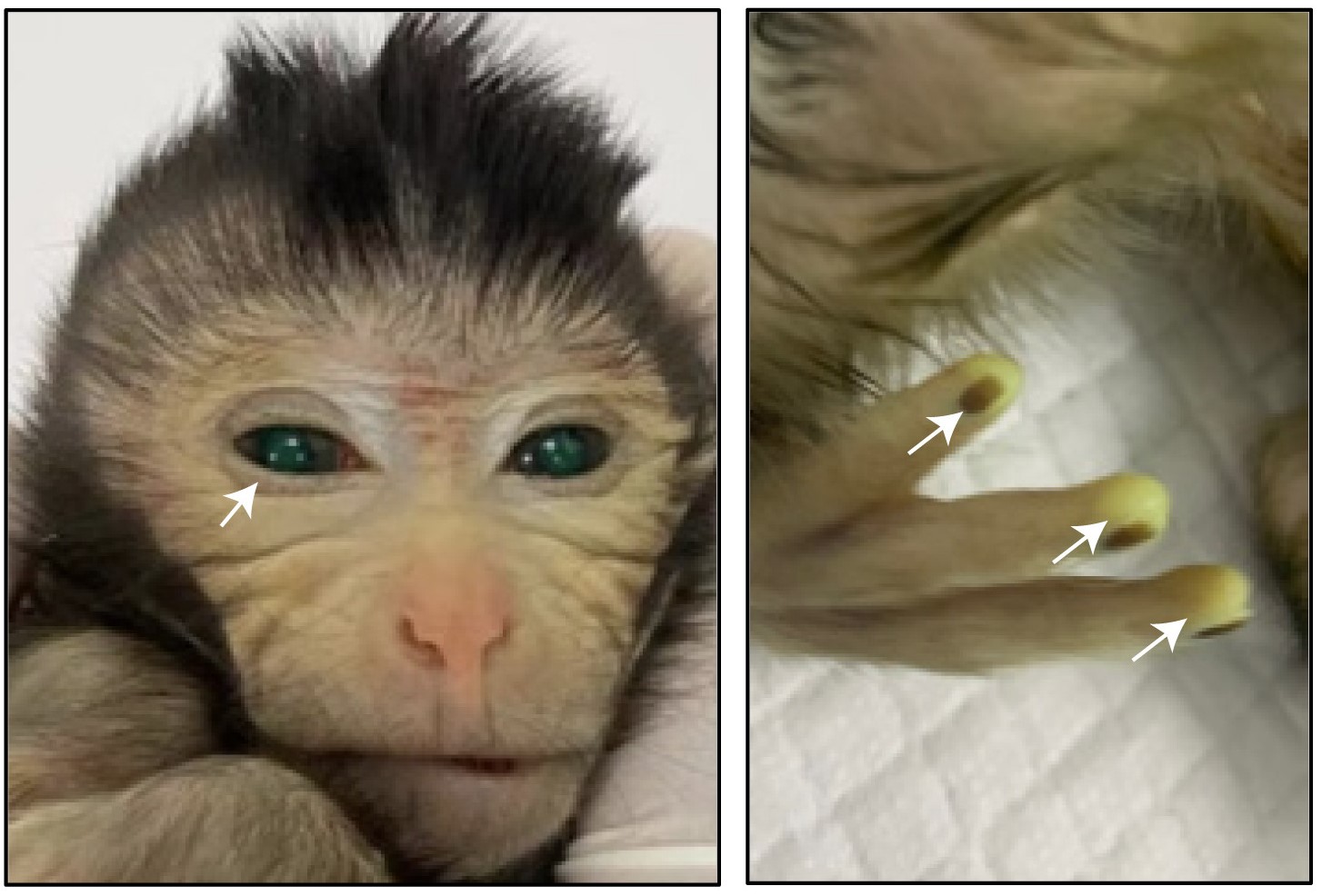 Images showing the green fluorescence signals in different body parts of a three-day-old chimeric monkey