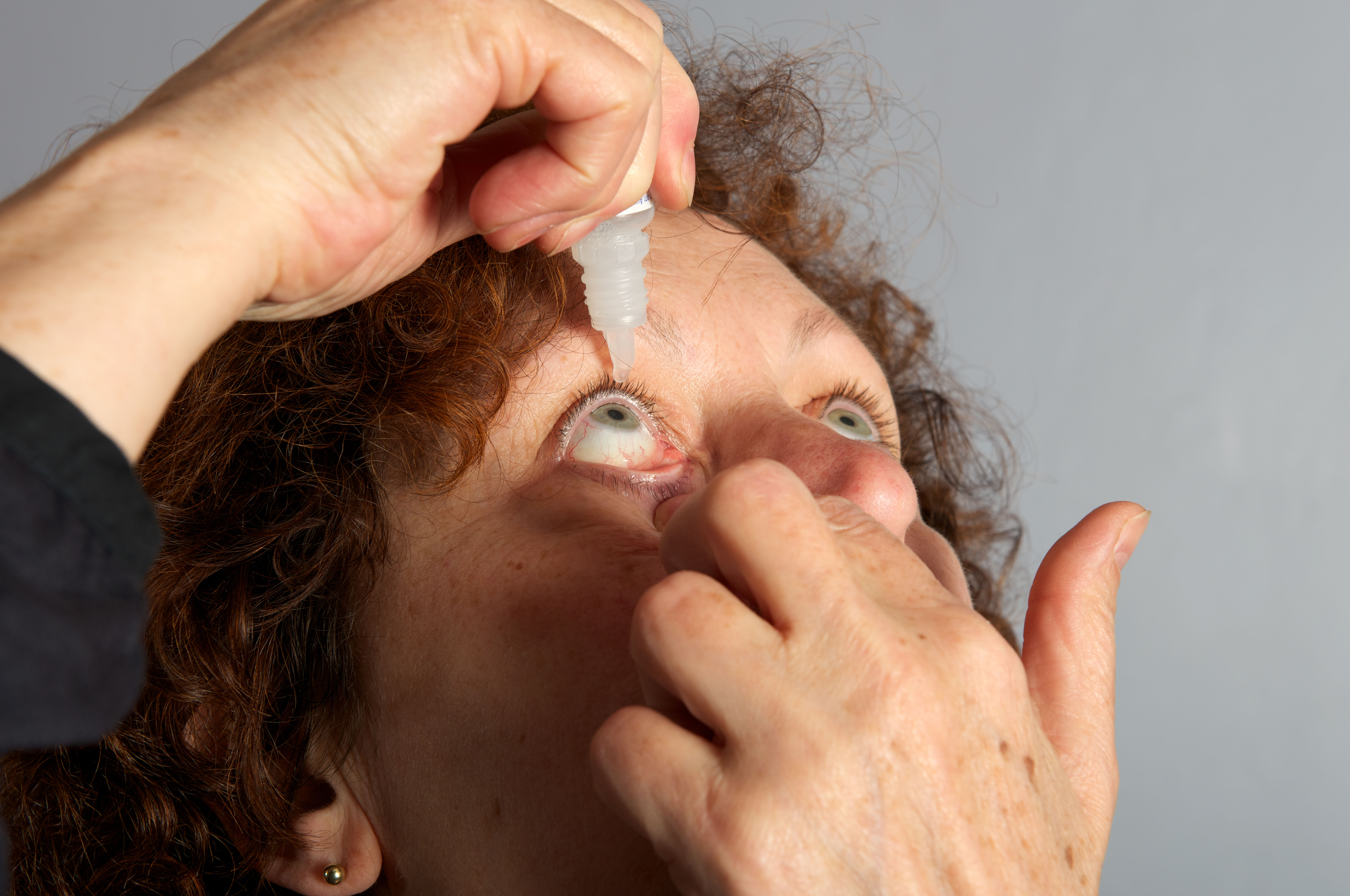 Hay fever sufferer using eye drops