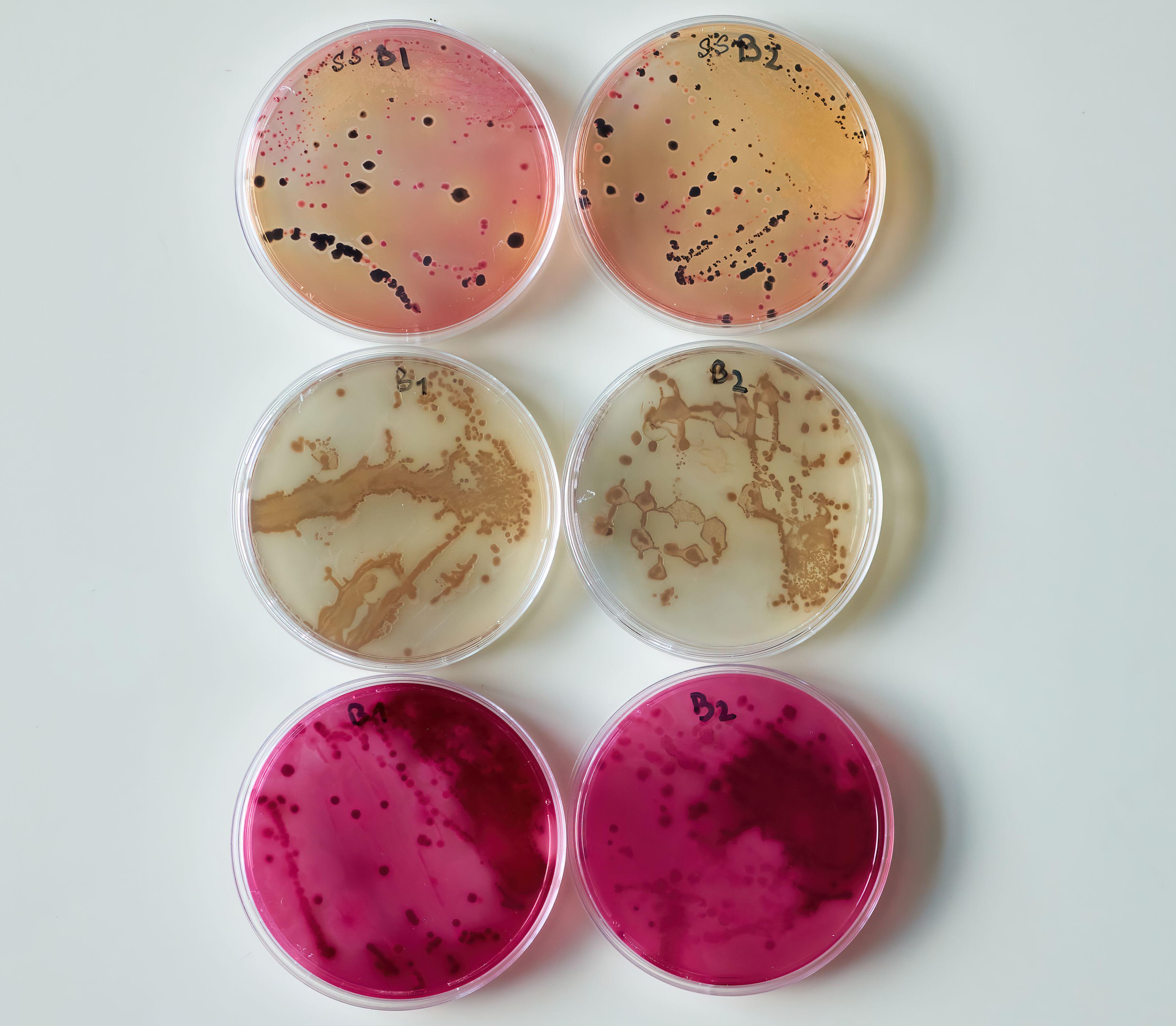 Bacterial colony in petri dishes (Alamy/PA)