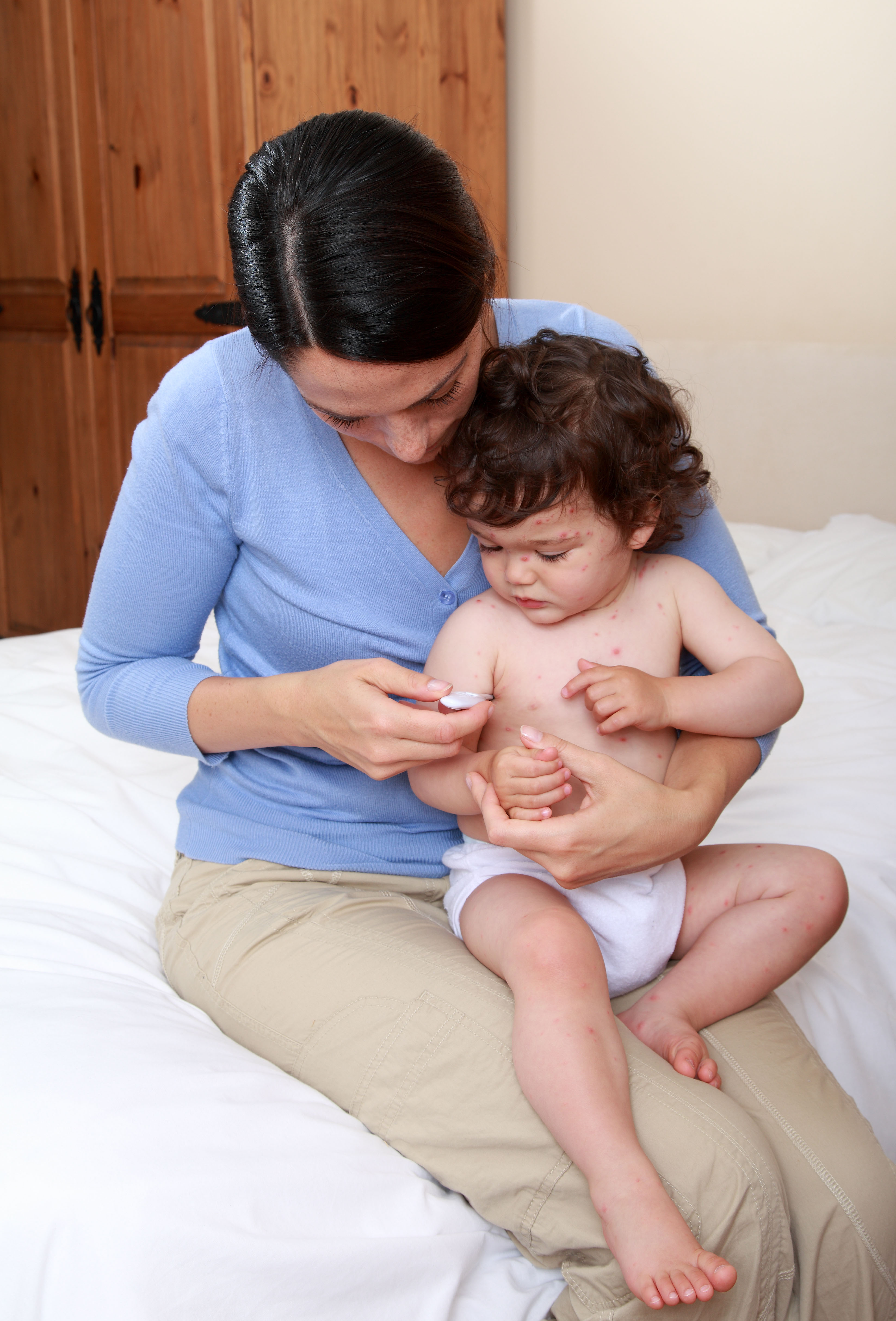 Mum taking temperature of baby with chickenpox