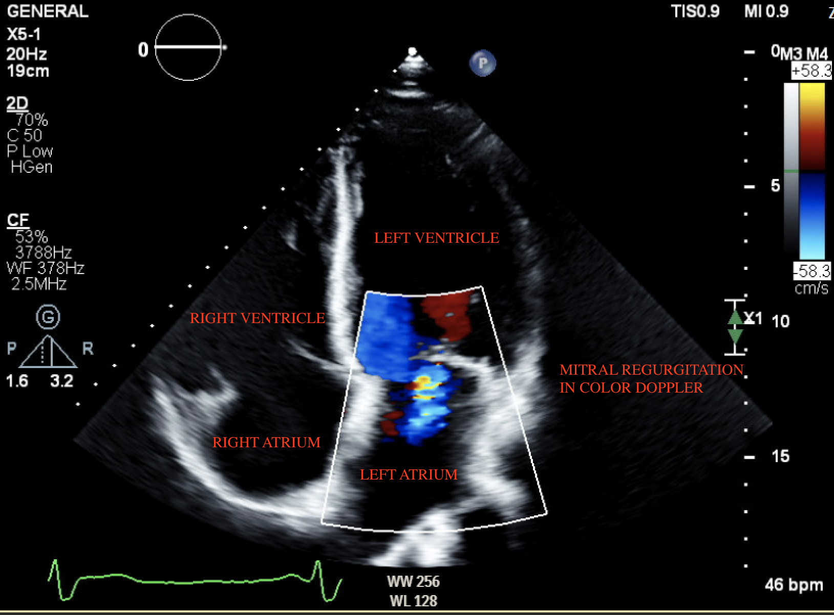 AI could ‘revolutionise’ care for heart failure patients, say ...