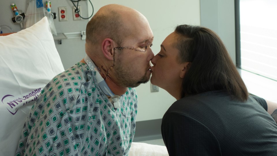 Aaron and wife Meagan kiss for first time since Aaron receives new face 