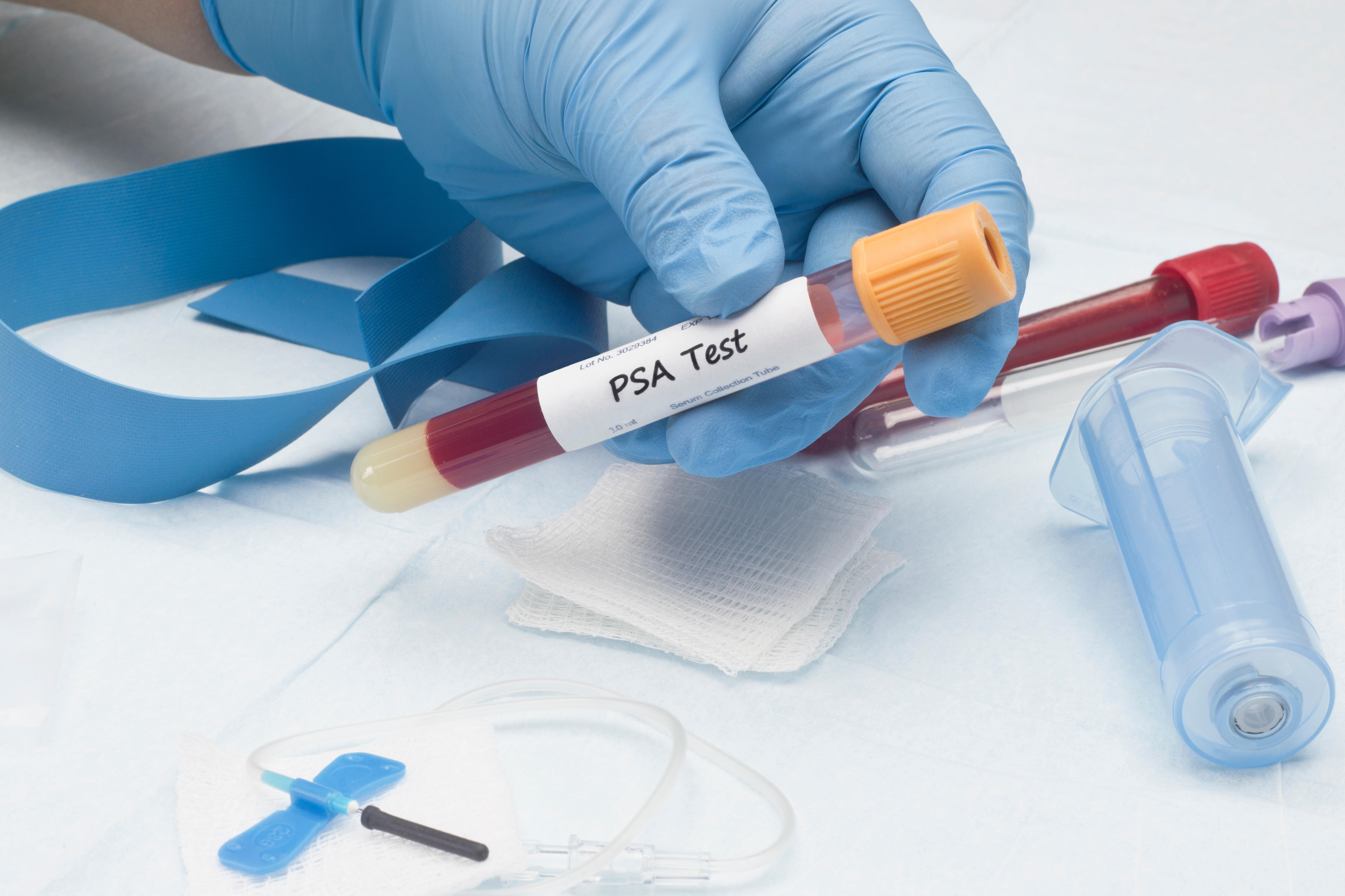 Prostate specific antigen test