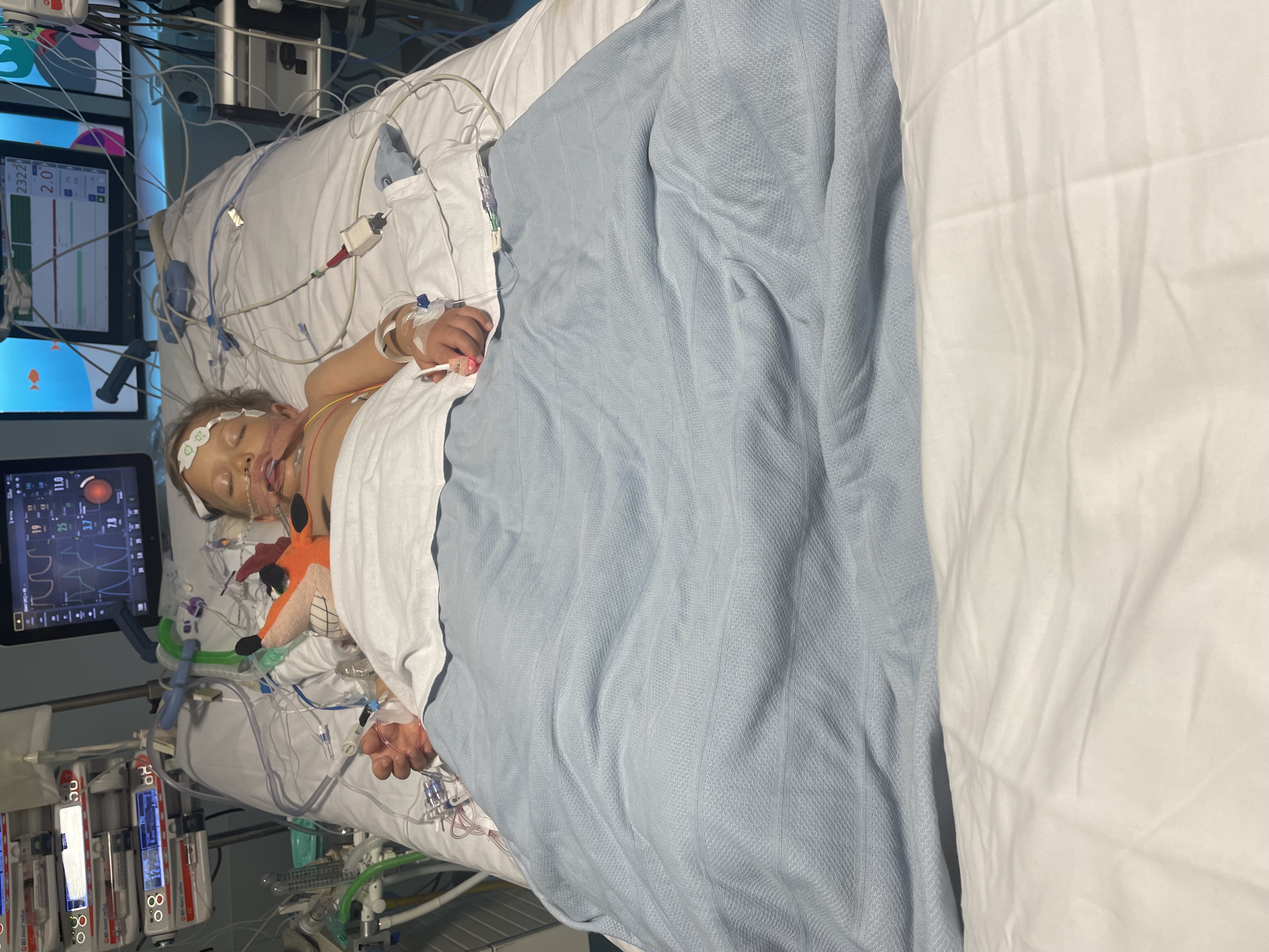 Isaac Perry asleep in a hospital bed with medical tubes attached to him