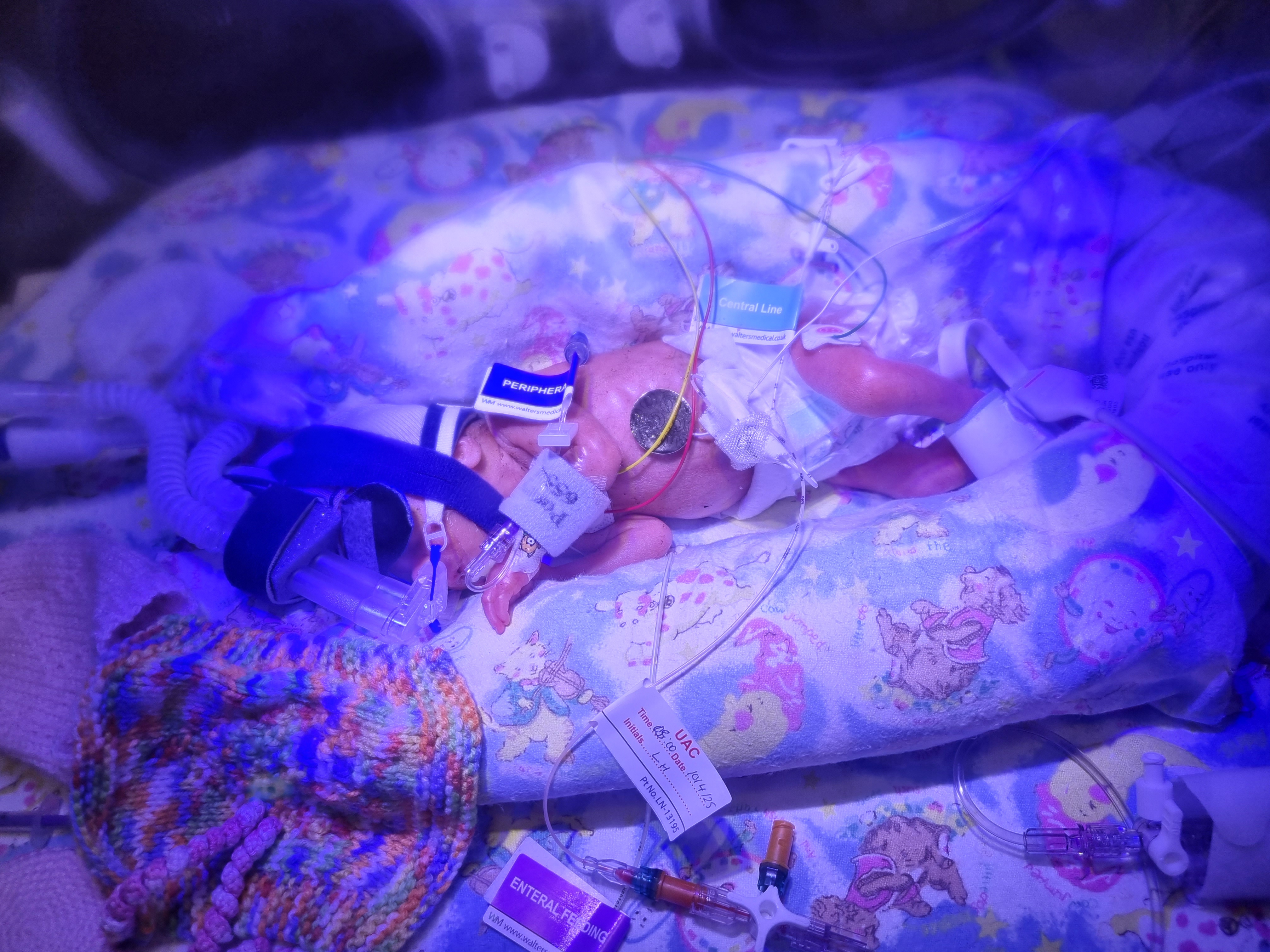 Baby Fiadh on the day she was born