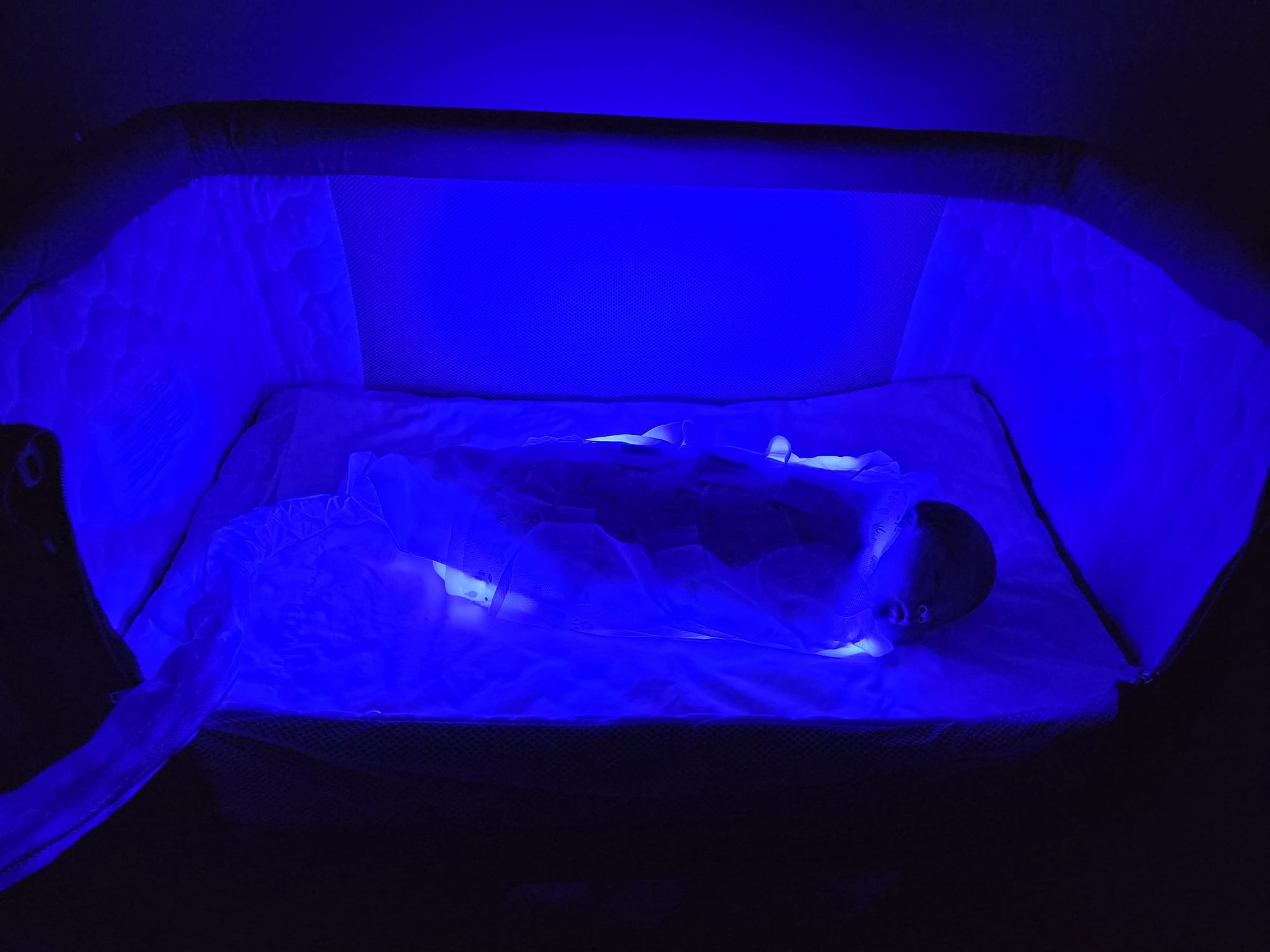 A baby being treated with light therapy in a crib