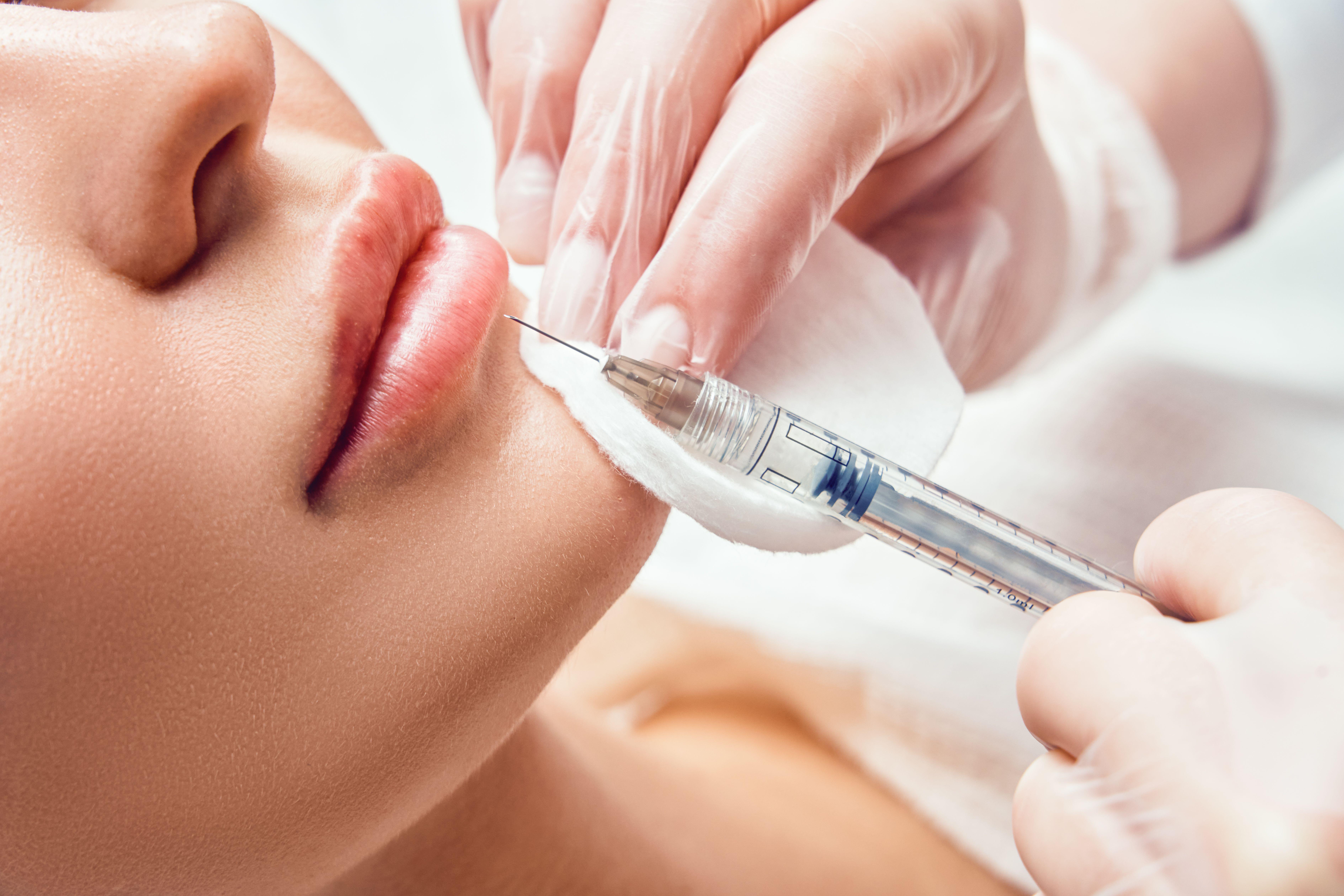 An injection being given near a lip 