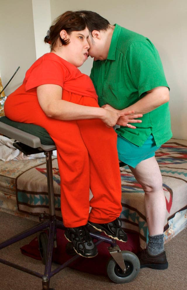 Oldest living conjoined twins, Lori and Schappell, die aged 62