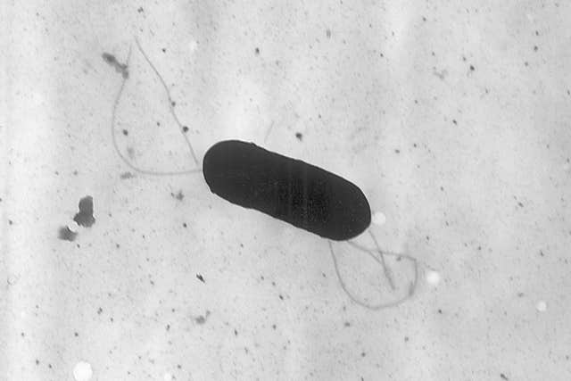 A listeria monocytogenes bacterium (Elizabeth White/CDC via AP)