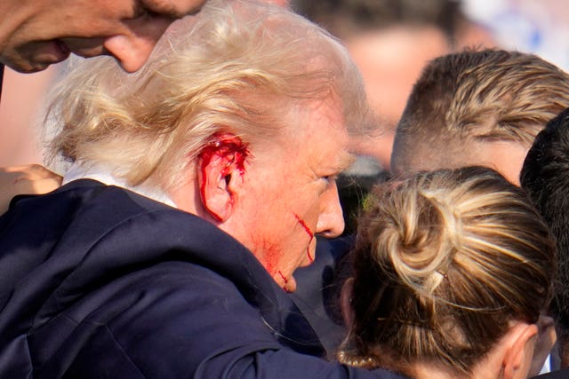 Donald Trump's ear bleeds after the gun attack
