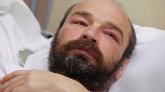 A close-up of Mikhail Pichugin in a hospital bed